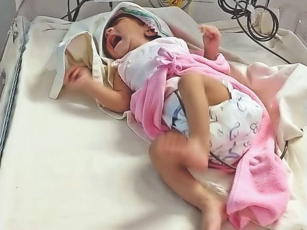 गर्भ में नहीं सुनाई दे रही थी धड़कन; परिजन बोले- डॉक्टर भाई-बहन ने उम्मीद नहीं छोड़ी, भरोसा दिलाया और नवजात को मिला नया जीवन