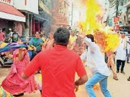 झुलसी कांग्रेस उपाध्यक्ष, बाल व पीठ जला