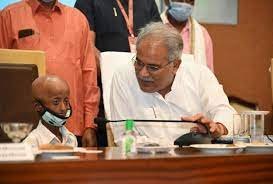 प्रोजेरिया पीड़ित आदिवासी लड़के से मिले मुख्यमंत्री भूपेश बघेल, बात कर जाना हालचाल