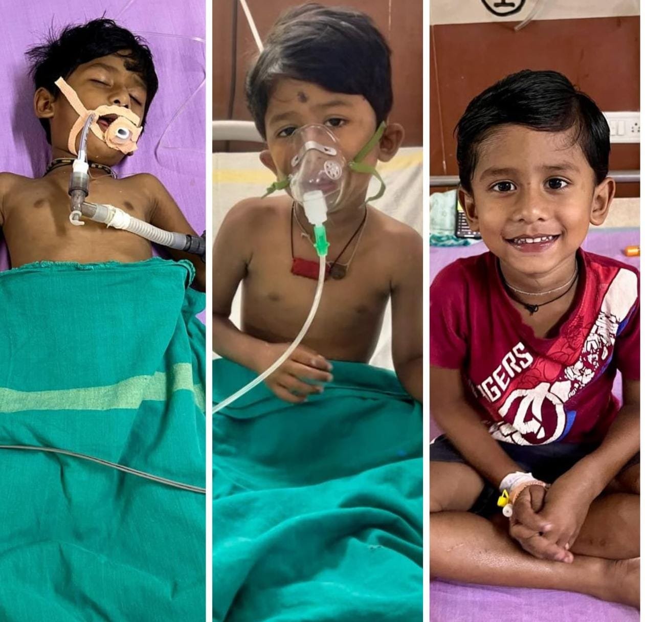 CG : करैत के डसने से मरणासन्न मासूम को मेडिकल कॉलेज हॉस्पिटल में मिला नया जीवन…